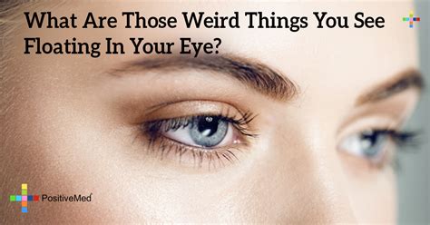 What Are Those Weird Things You See Floating In Your Eye