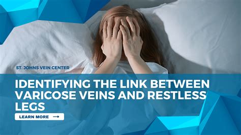 Identifying The Link Between Varicose Veins And Restless Legs St Johns Vein Center