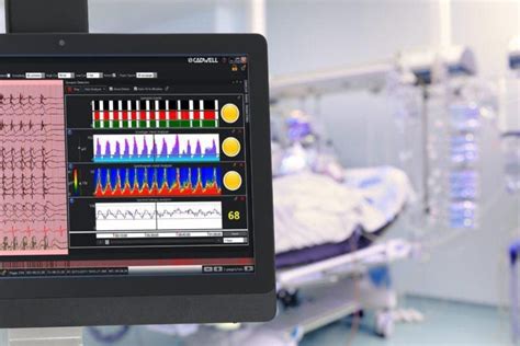 Eeg Machine Eeg Equipment Portable Eeg Brain Monitoring