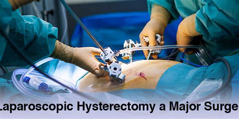 Is Laparoscopic Hysterectomy Considered As A Major Surgery