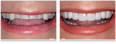 Newport Beach Dental - We are general and cosmetic dentists in Newport Beach, CA providing a ...