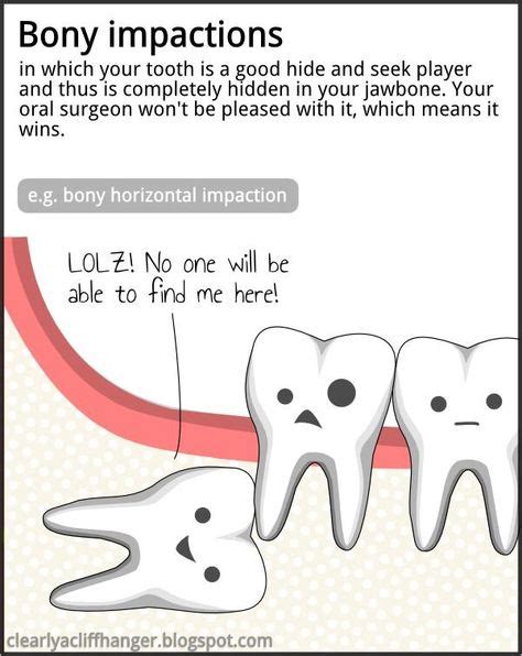 25 Wisdom Teethimportant Facts Ideas Wisdom Teeth Teeth Dental