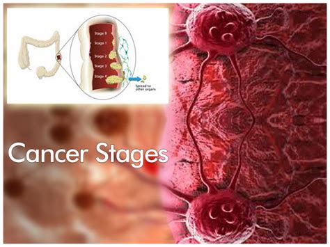 Cancer PPT, Cancer Slides, Cancer symptoms, Breast cancer, Lung cancer 