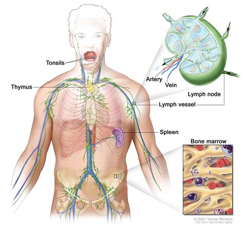 Lymphomapatient Version National Cancer Institute