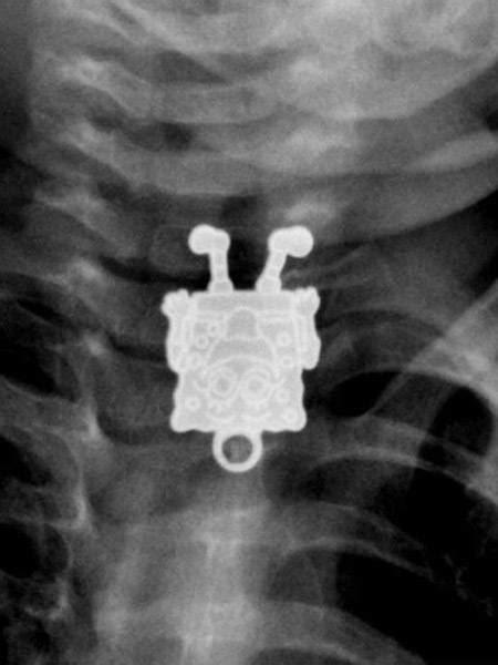 31 Funny X Ray Images That Seem Too Ridiculous To Be Real