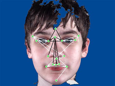 Is It Autism Facial Features That Show Disorder Photo 7 Pictures