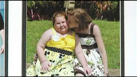 obese but starving girl constantly gains weight due to rare disorder fox8 wghp