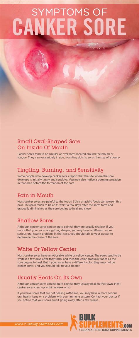 Canker Sores Symptoms Causes And Treatment