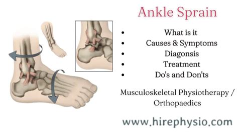 3 Way Effective Treatment Options For Ankle Sprains Get Quick Relief