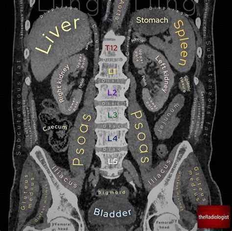 Anatomical Structures On Ct Abdomen Ranatomy