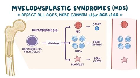 Myelodysplastic Syndrome Symptoms Causes Types Top 4 Ultimate Risk