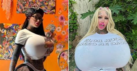 Woman Who Spent More Than 100k On Extreme Plastic Surgery Has Shared ‘before And After’ Photos