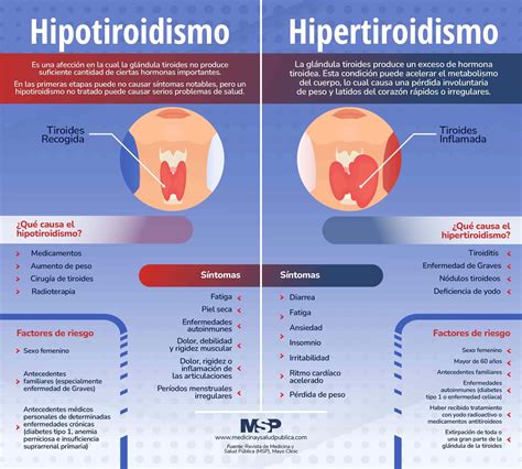 Hipotiroidismo Vs Hipertiroidismo Infograf A