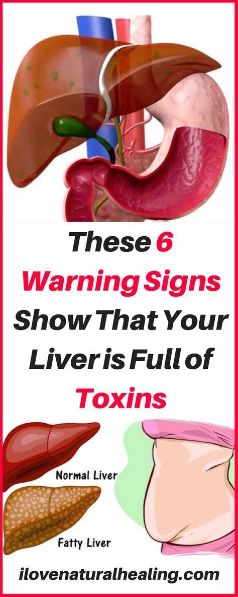 These 6 Warning Signs Show That Your Liver Is Full Of Toxins I Love