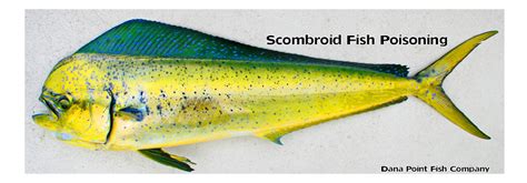 Scombroid Fish Poisoning Dana Point Fish Company