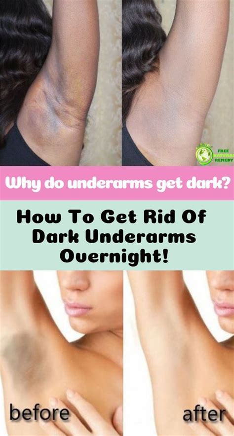To make your armpits lighter just follow the below procedures. How to Lighten and Prevent Dark Underarms in 2020 | Dark ...