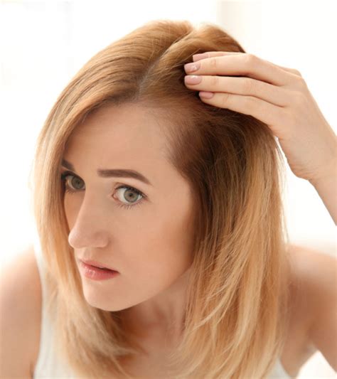 Lupus Hair Loss Causes Types And Treatment