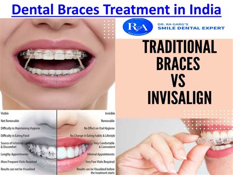 Ppt Orthodontic Oral Treatments As Invisible Aligner And Dental