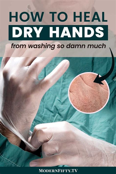 Best Way To Heal Dry Cracked Hands Beauty And Health