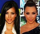 Kim Kardashian, antes y después de las cirugías! | Curiosos