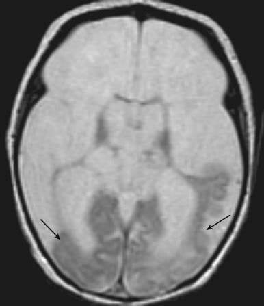 Brain Imaging Radiology Key