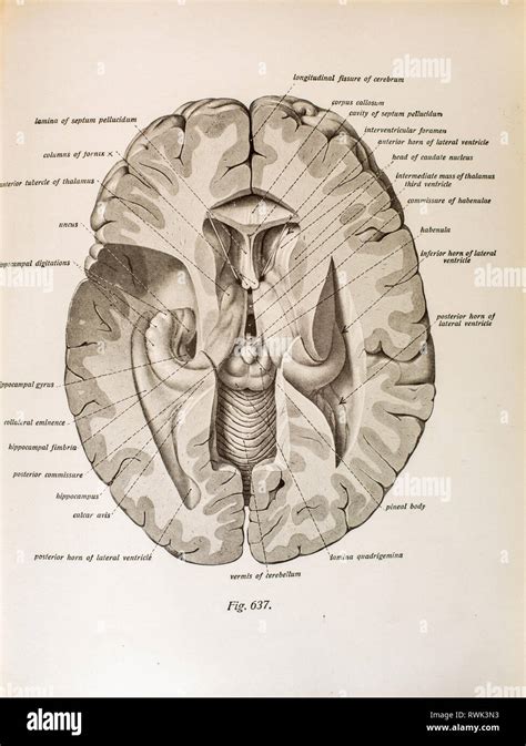 Antique Illustration Of A Dissection Of Human Brain Showing Occipital