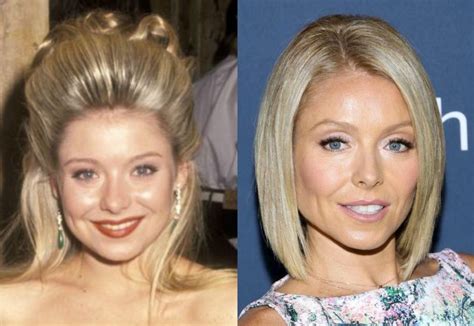 Kelly Ripa Before And After Plastic Surgery 13 Celebrity Plastic