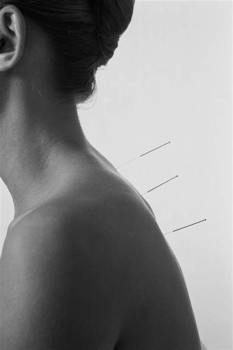 Heres Exactly What To Expect From Your First Acupuncture Appointment Acupuncture Acupuncture