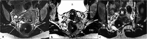 transverse scan at the level of the cervix and coccyx in healthy download scientific diagram