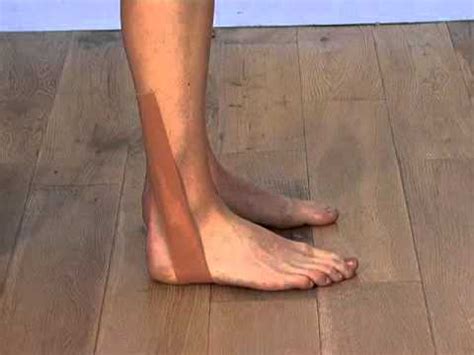 The bones and joints in the feet experience wear and tear, so conditions that cause damage to the foot can directly affect its health. Effective sports taping for peroneal tendonitis - YouTube