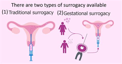 Artificial Insemination Cost With Surrogate Surrogate Mother Kenya
