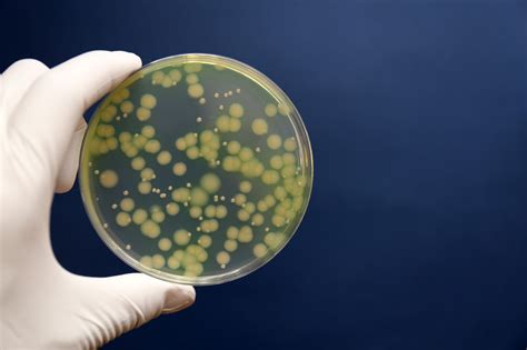 Pseudomonas Aeruginosa Pseudomonas Testing