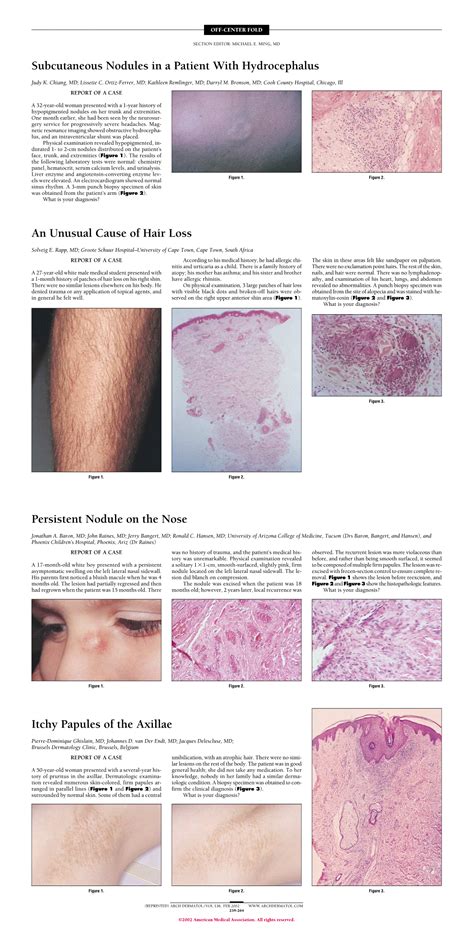 Subcutaneous Nodules In A Patient With Hydrocephalus Dermatology