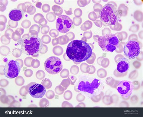 Kind White Blood Cell Peripheral Blood Stock Photo 407557576 Shutterstock