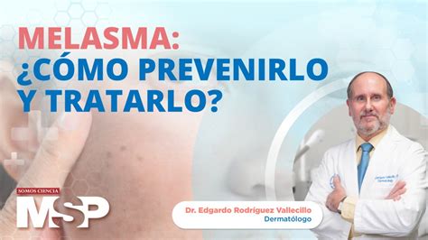 Melasma ¿cómo Prevenirlo Y Tratarlo