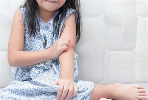 Skin Rashes In Children Learn The Most Common Causes