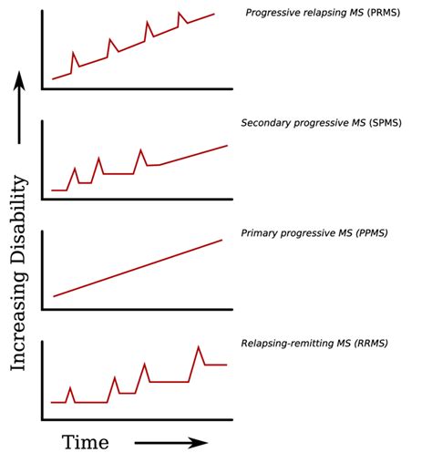 The different types of multiple sclerosis. 3: Evolution of the four dierent clinical types of ...