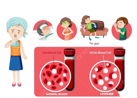 Leukemia Symptoms Cartoon Style Infographic Healthy Symptoms Frame
