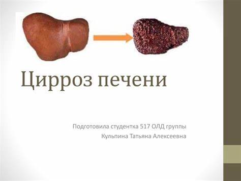 Цирроз печени диета 1 Цирроз печени - презентация онлайн Цирроз печени - презентация онлайн Цирроз печени диета 1