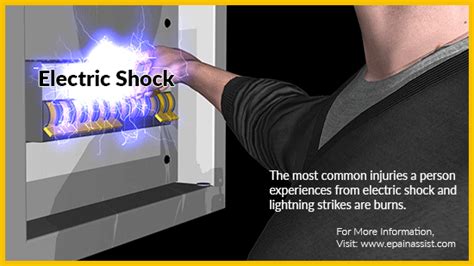 Electric Shock Treatment Prevention Prognosis Symptoms