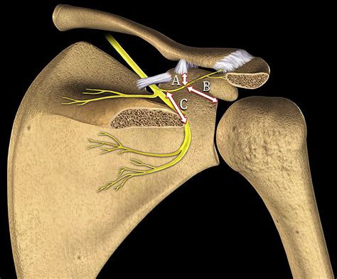 The Suprascapular Nerve And Its Articular Branch To The