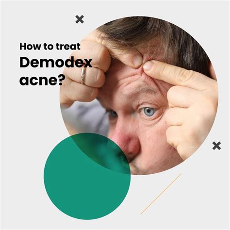 How To Treat Demodex Acne Ungex Aims To Eliminate Mites With Its