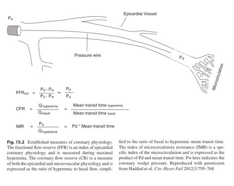 Fractional Flow Reserve Ffr Established Measures Grepmed