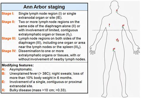 Ann Arbor Staginghodgkin Lymphoma Free Medical Medical Oncology