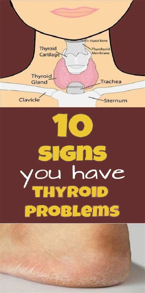 10 Signs You Have A Thyroid Problem And 10 Solutions For It Healthy Round