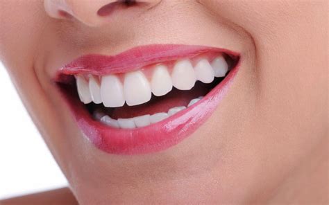 Teeth Whitening Llandeilo Dental Practice