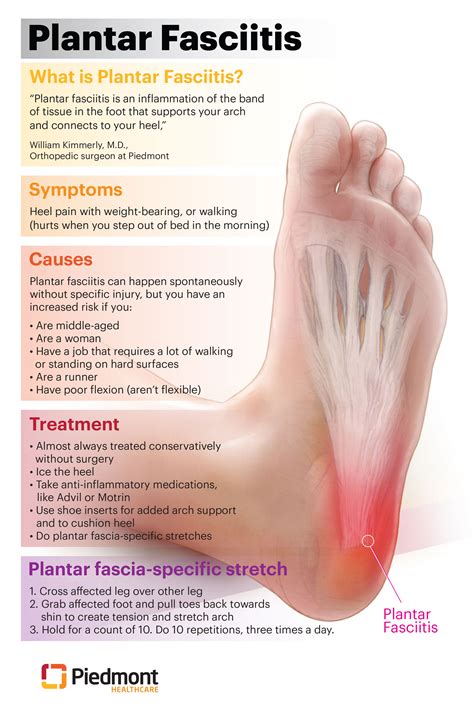 Plantar Fasciitis Pain In Middle Of Foot Online