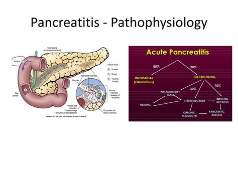 Do Antibiotics Help Pancreatitis