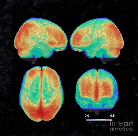 Bipolar Brain 3d Mri Scan Photograph By Science Source Fine Art America