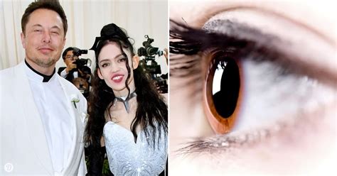 Singer Grimes Surgically Removed Top Film Of Her Eyeball To Cure Depression